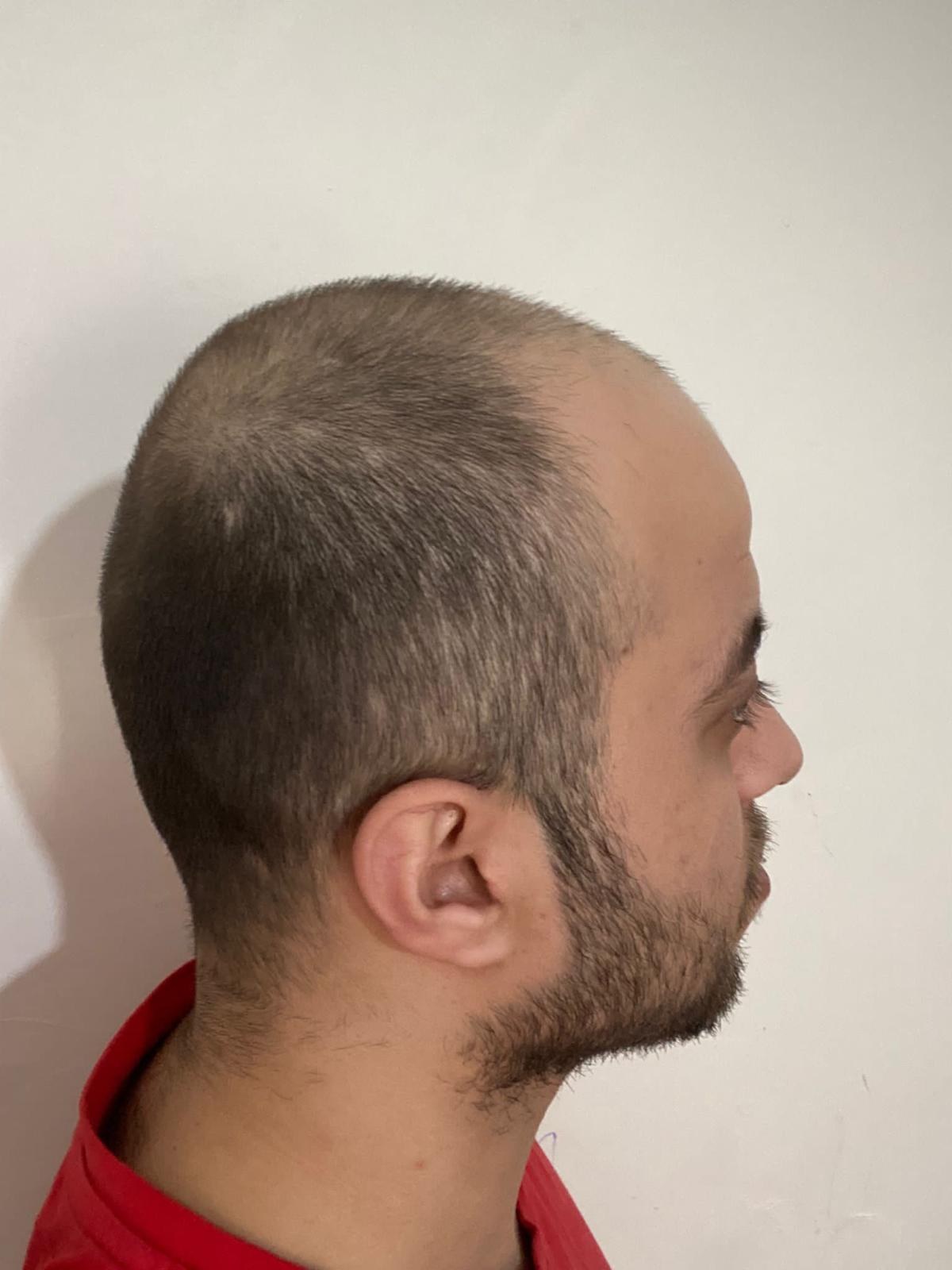 Vaka 07 Safir FUE — öncesi