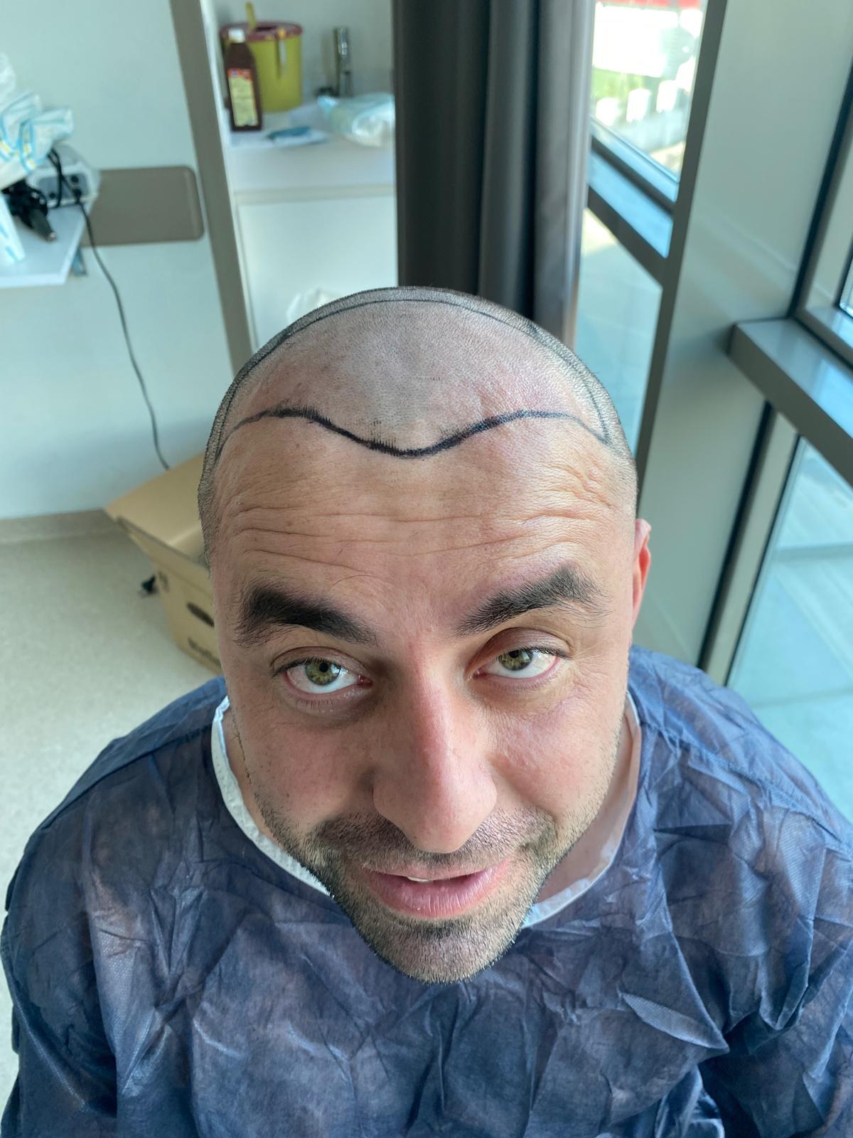Vaka 03 DHI — öncesi