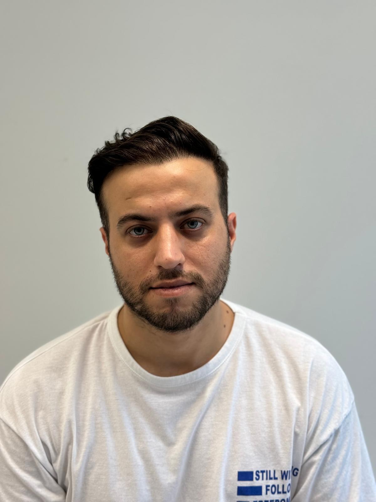 Vaka 07 Safir FUE — sonrası